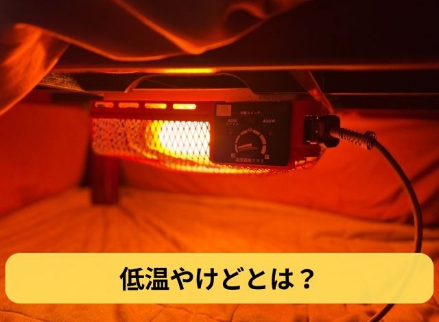 低温やけどとは?