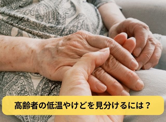 高齢者の低温やけどを見分けるには?