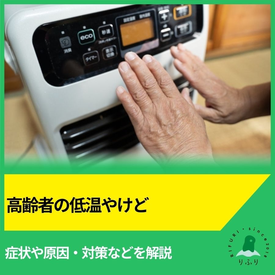 高齢者の低温やけど|症状や原因・対策などを解説